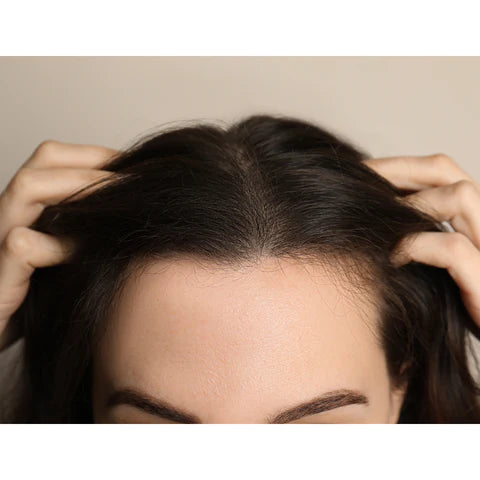 SHE Newsletter Volume 5 - Thin Hair Issue